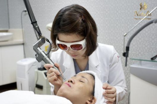 khử thâm môi bằng laser